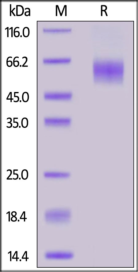 IL-1 Rrp2 / IL-1 R6 Recombinant Protein