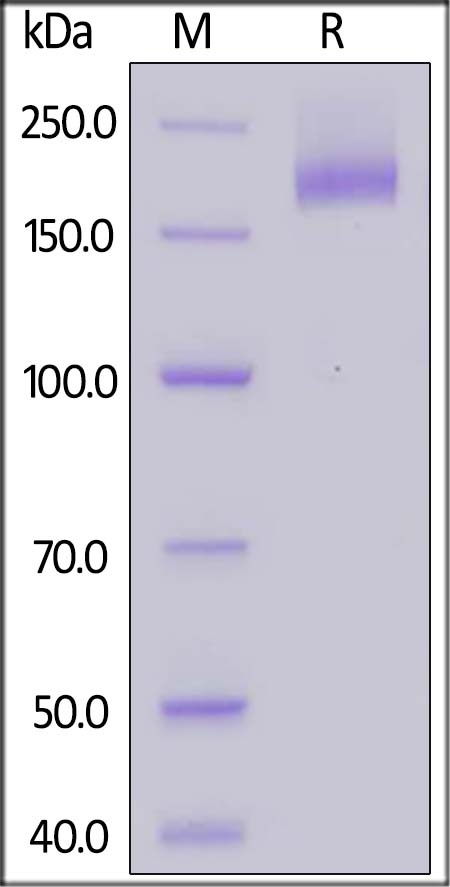 SARS-CoV S Recombinant Protein (R667A, K968P, V969P)