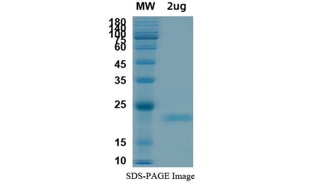 SARS-CoV-2 (COVID-19) E Recombinant Protein