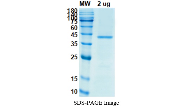 SARS-CoV-2 (COVID-19) S + M + E Recombinant Protein