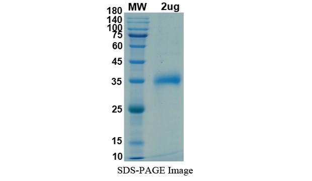 SARS-CoV-2 (COVID-19) South African variant (B.1.351) S RBD (K417N, E484K, N501Y) Recombinant Protein
