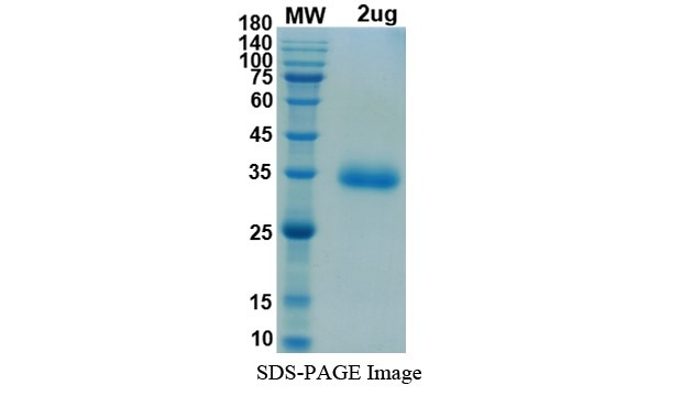 SARS-CoV-2 (COVID-19) UK variant (B.1.1.7) S RBD (N501Y) Recombinant Protein