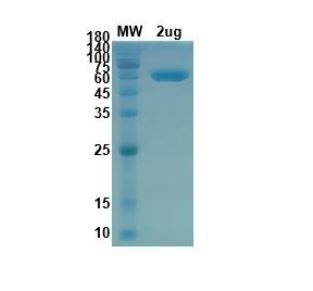 SARS-CoV-2 (COVID-19) S Protein RBD Recombinant Protein