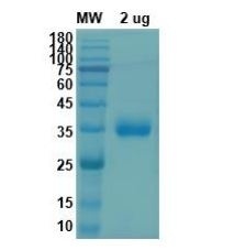 SARS-CoV-2 (COVID-19) S RBD Recombinant Protein