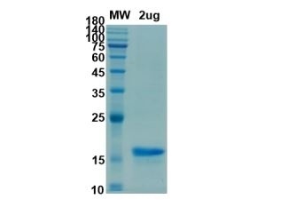 SARS-CoV-2 (COVID-19) M Recombinant Protein