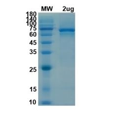 SARS-CoV-2 (COVID-19) NSP13 Recombinant Protein