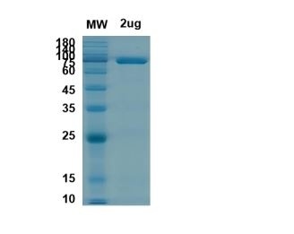 SARS-CoV-2 (COVID-19) NSP2 Recombinant Protein