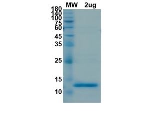 SARS-CoV-2 (COVID-19) NSP9 Recombinant Protein