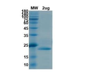 SARS-CoV-2 (COVID-19) NSP1 Recombinant Protein