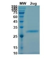 SARS-CoV-2 (COVID-19) S RBD Recombinant Protein