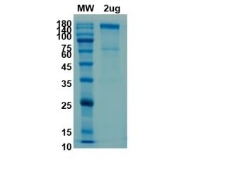 SARS-CoV-2(COVID-19) Spike Recombinant Protein