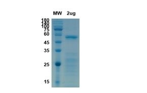 SARS-CoV-2 (COVID-19) Nucleocapsid Recombinant Protein