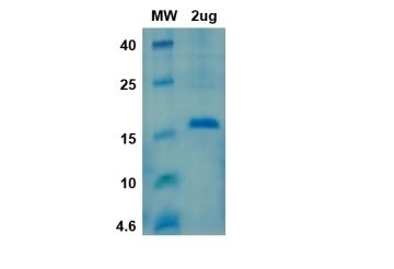 SARS-CoV-2 (COVID-19) NSP10 Recombinant Protein