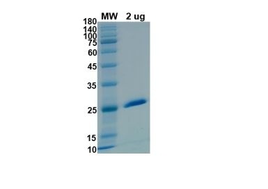 SARS-CoV-2 (COVID-19) NSP3 Recombinant Protein