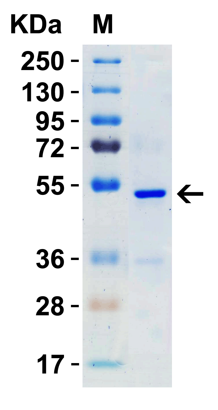 SARS-CoV-2 (COVID-19) Nucleocapsid Recombinant Protein