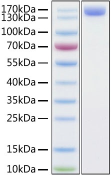 Human ACE2 Recombinant Protein