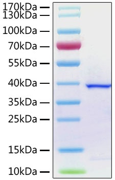 SARS-CoV-2 (COVID-19) Papain-like Protease