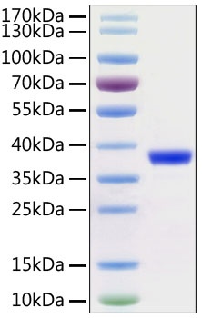 SARS-CoV-2 (COVID-19) 3C-like Proteinase