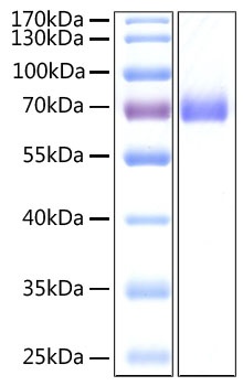 SARS-CoV-2 (COVID-19) Spike S2 ECD Recombinant Protein