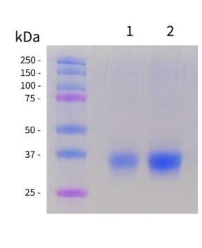 SARS-CoV-2 (COVID-19) RBD Recombinant Protein