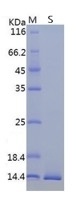 SARS-CoV-2 (COVID-19) ORF8 Recombinant Protein