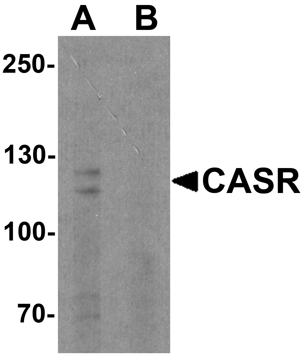 CASR Peptide