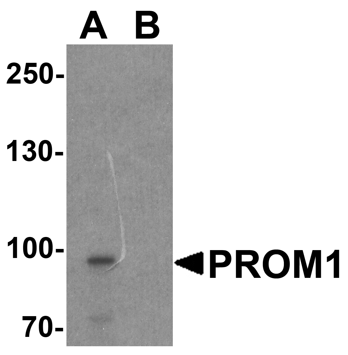 PROM1 Peptide
