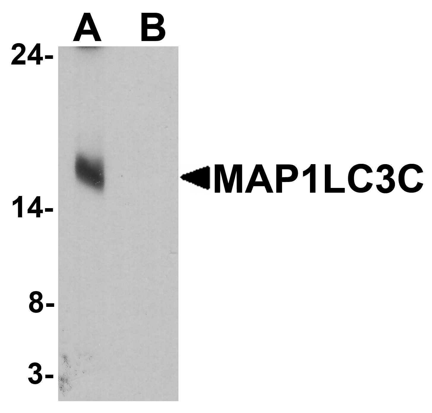 MAP1LC3C Peptide
