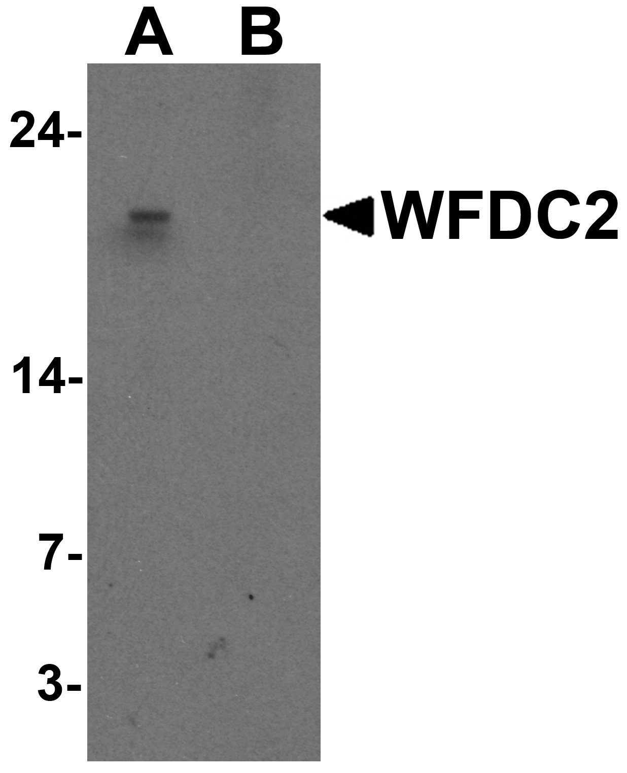 WFDC2 Peptide