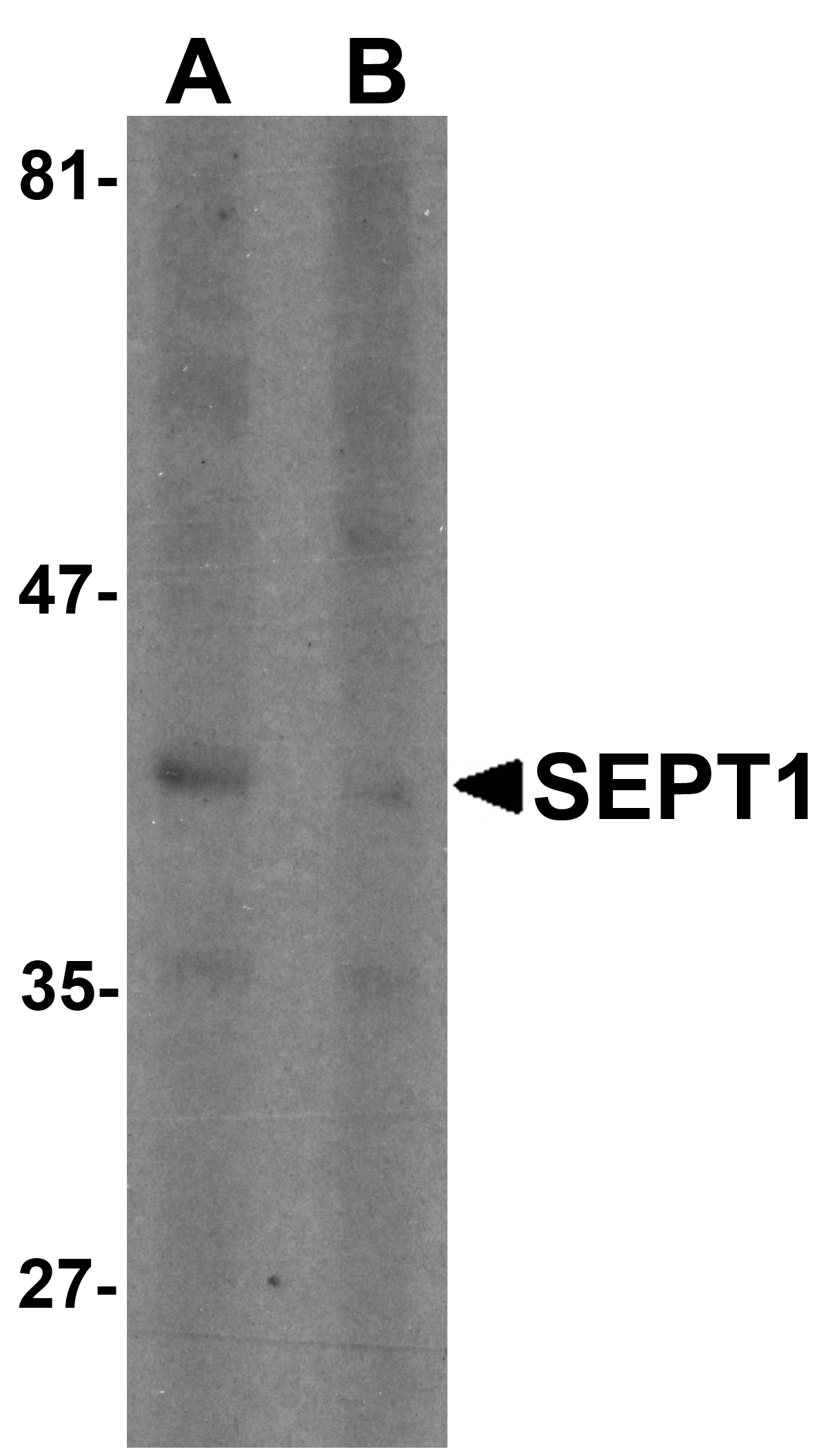 SEPT1 Peptide
