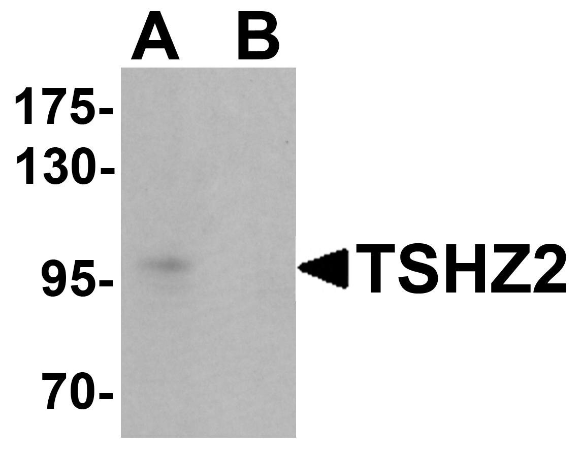TSHZ2 Peptide