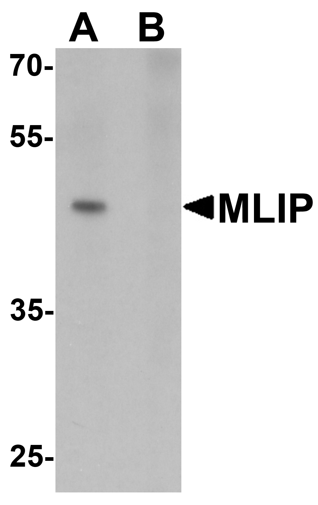 MLIP Peptide