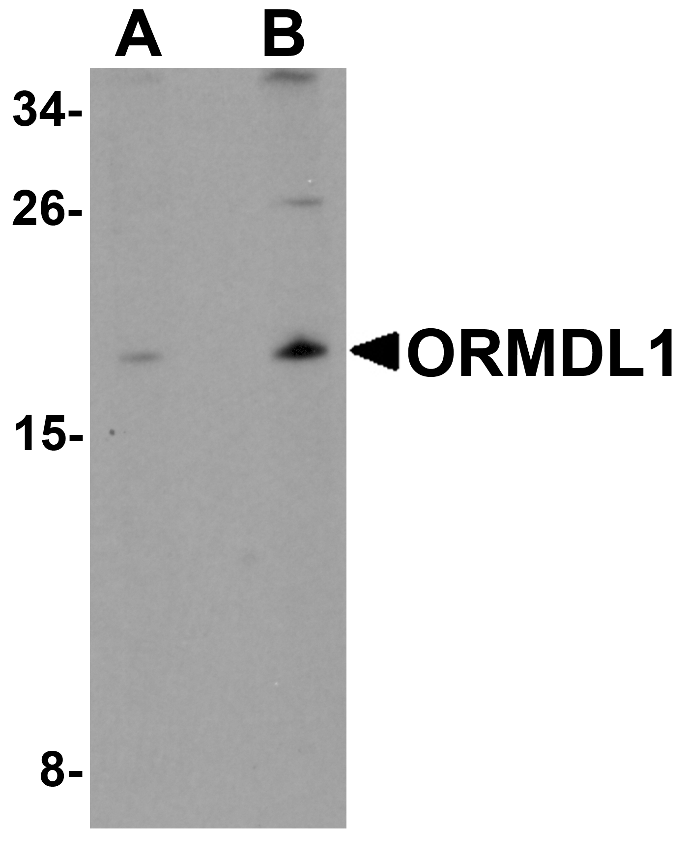 ORMDL1 Peptide