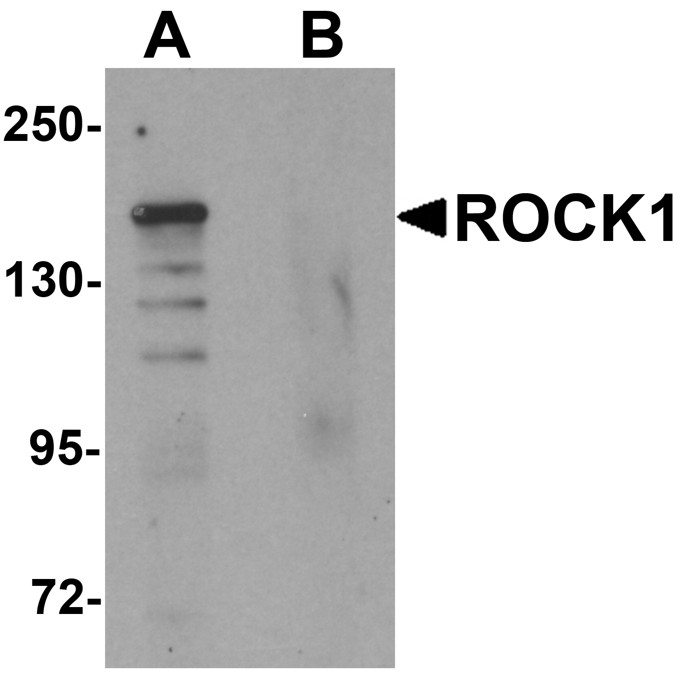 ROCK1 Peptide