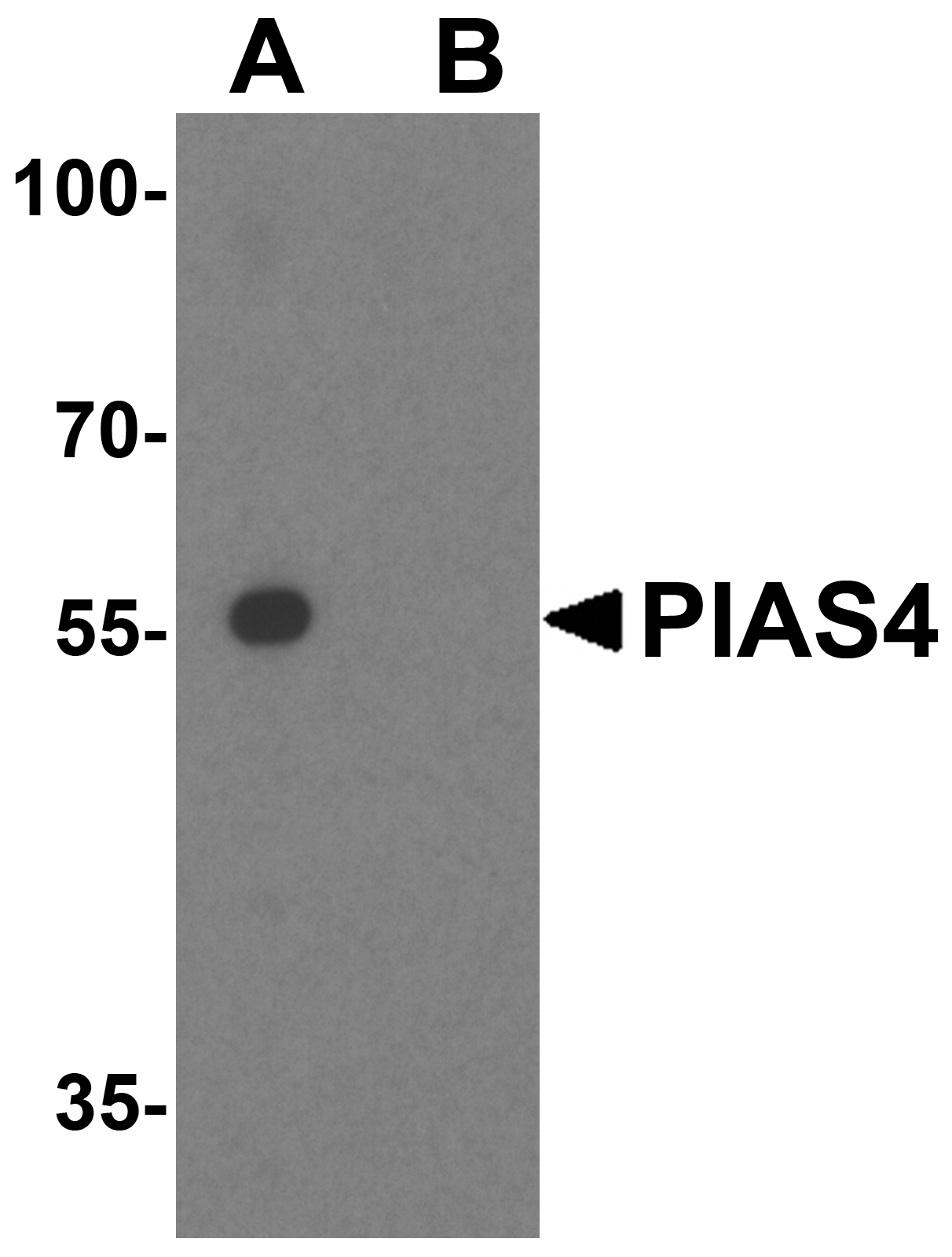 PIAS4 Peptide