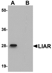 LIAR Peptide