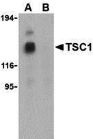 TSC1 Peptide