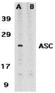 ASC Peptide