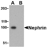 Nephrin Peptide