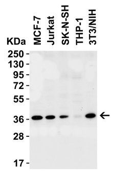 PEX10 (CT) Antibody
