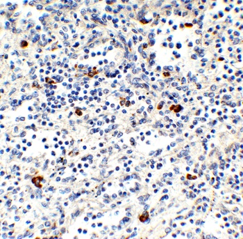 MNDA Antibody