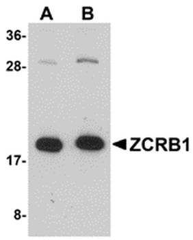 ZCRB1 Antibody