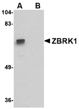 ZNF350 Antibody