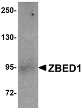 ZBED1 Antibody