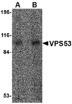 VPS53 Antibody