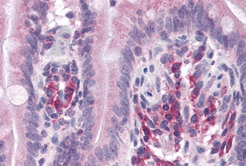 VARP Antibody