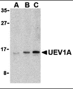 UBE2V1 Antibody