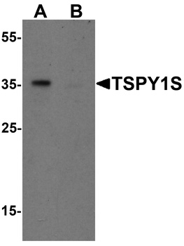 TSPY1 Antibody