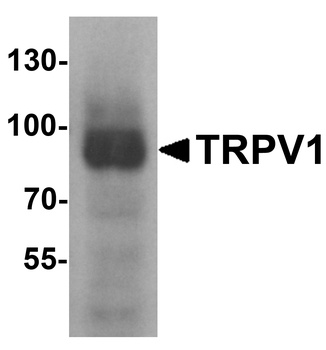 TRPV1 Antibody