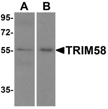 TRIM58 Antibody